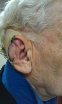 Новое ухо из реактора