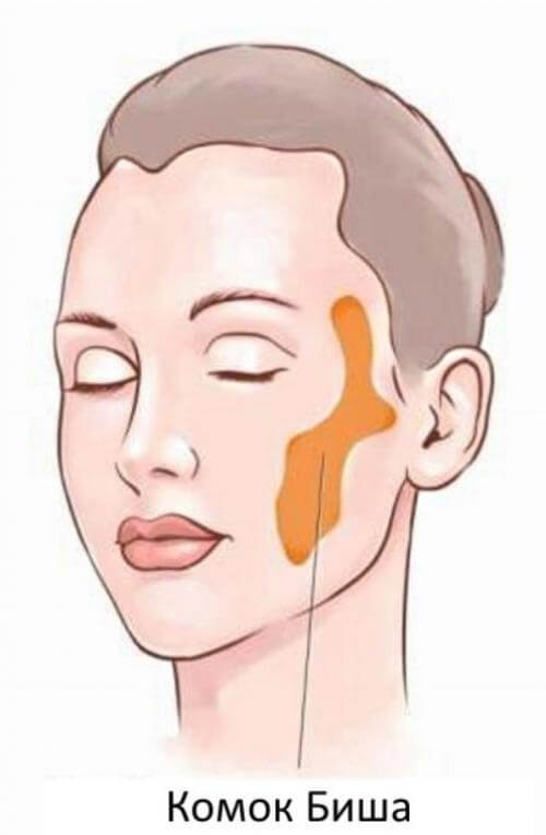 Комки Биша рисунок